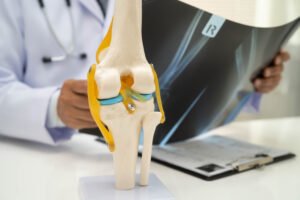 doctor-examining-knee-joint-bone-radiography-xray-film