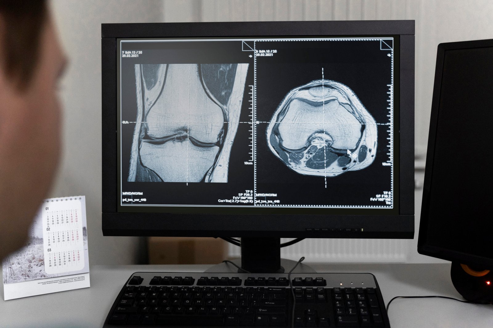 Knee Surgery Terminology Guide 1 doctor-looking-ct-scans-computer