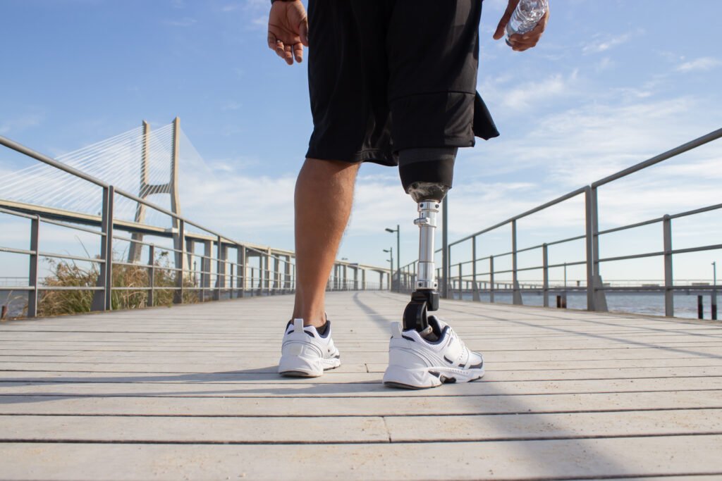 back-view-man-with-mechanical-leg-sunny-day-sportsman-black-shorts-white-sneakers-photographed-training-sport-disability-hobby-concept