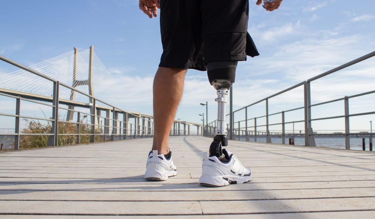 back-view-man-with-mechanical-leg-sunny-day-sportsman-black-shorts-white-sneakers-photographed-training-sport-disability-hobby-concept
