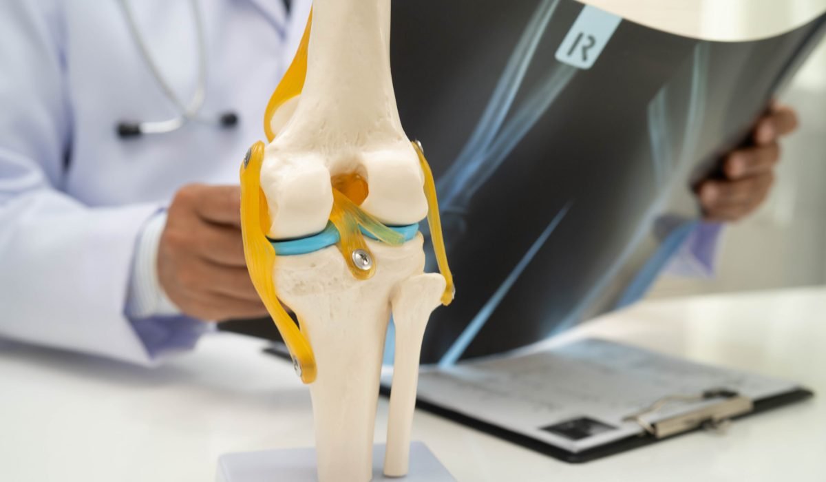 doctor-examining-knee-joint-bone-radiography-xray-film